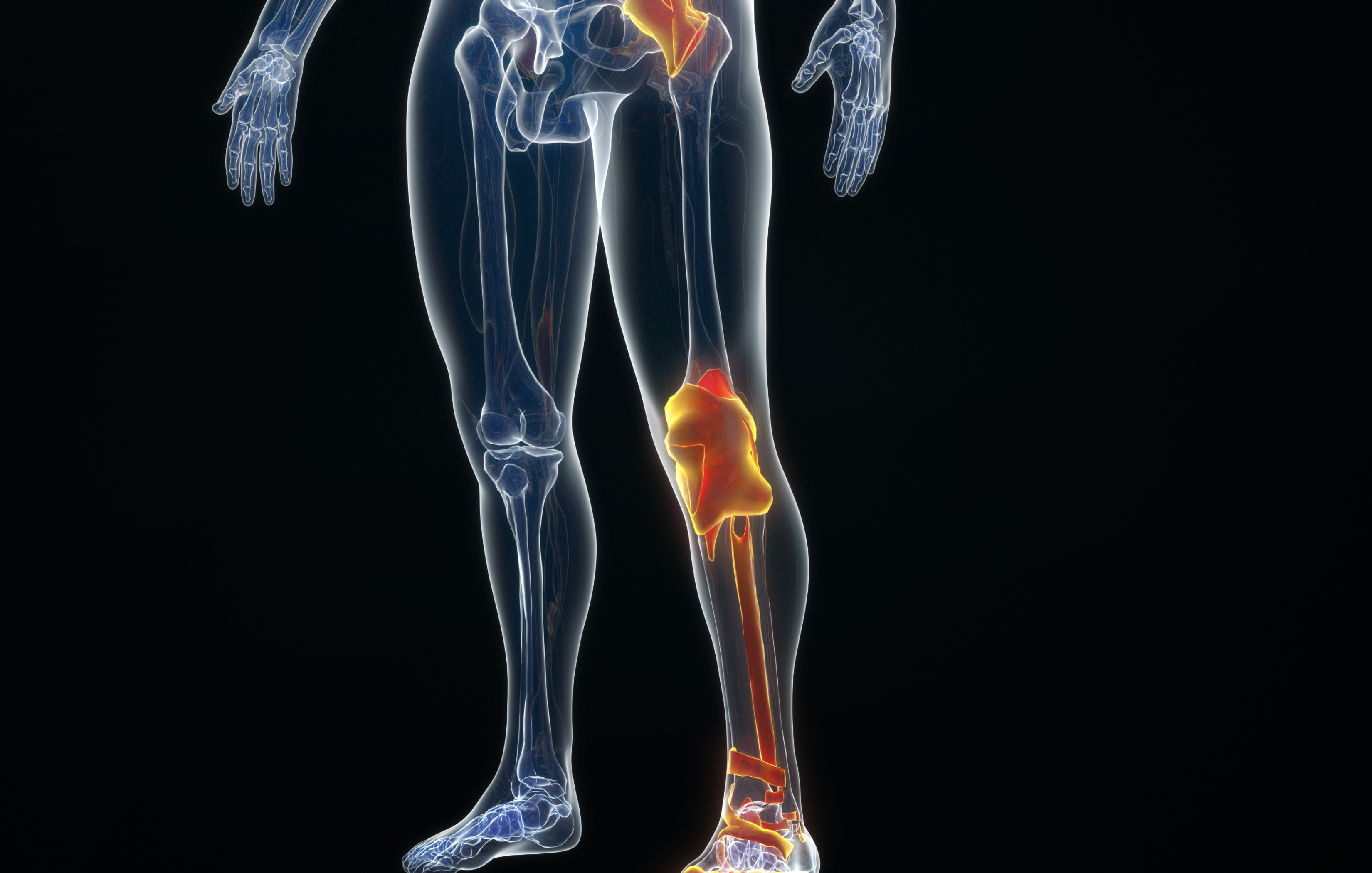 ACL Reconstruction Surgery By Firstcure Health