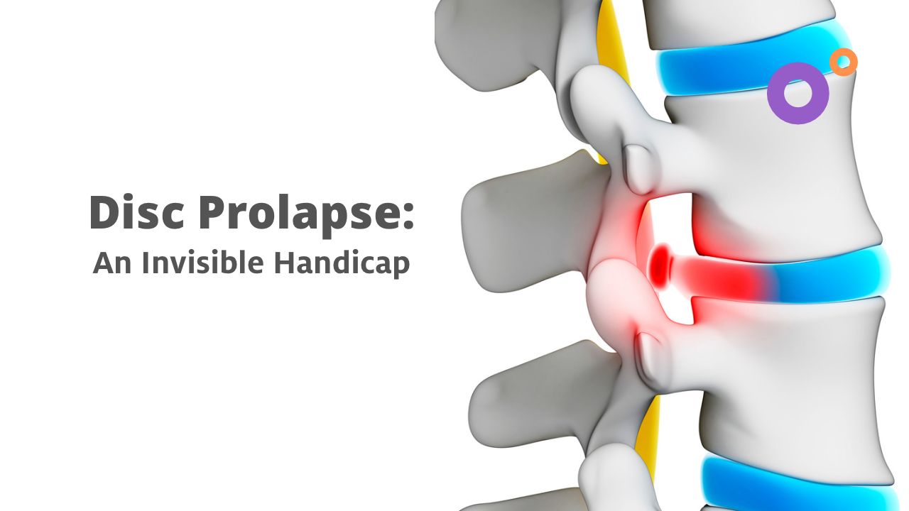 Disc Prolapse